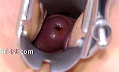 Gyno Mirror In Her Sticky Snatch